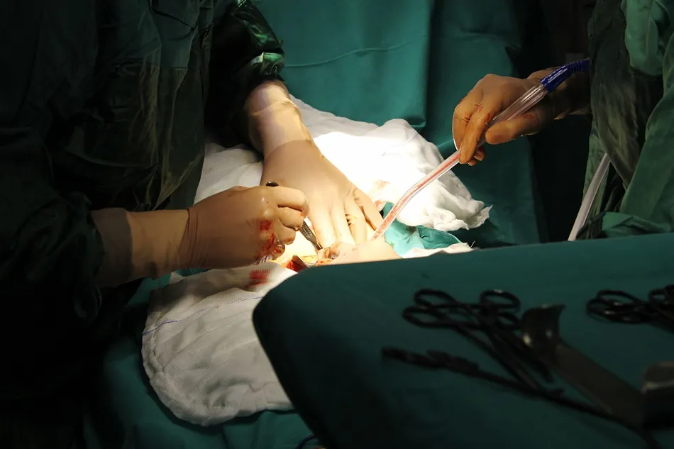 laparoscopic-appendix-removal-in