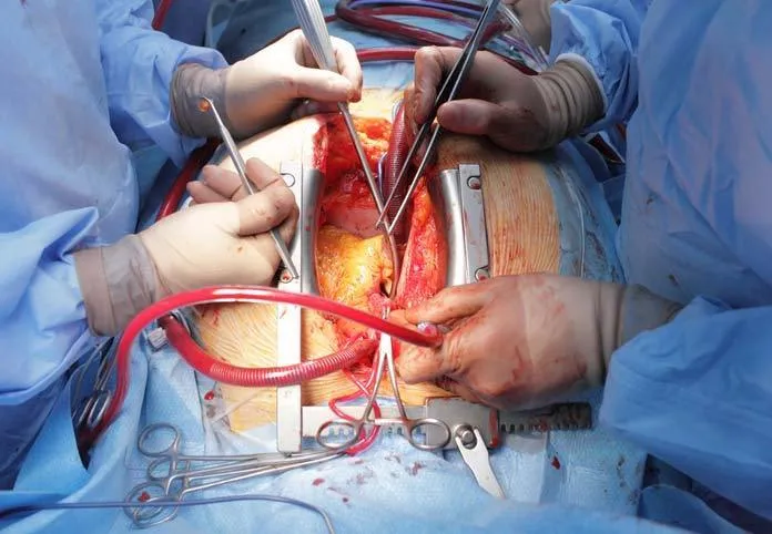 cardiothoracic-surgery