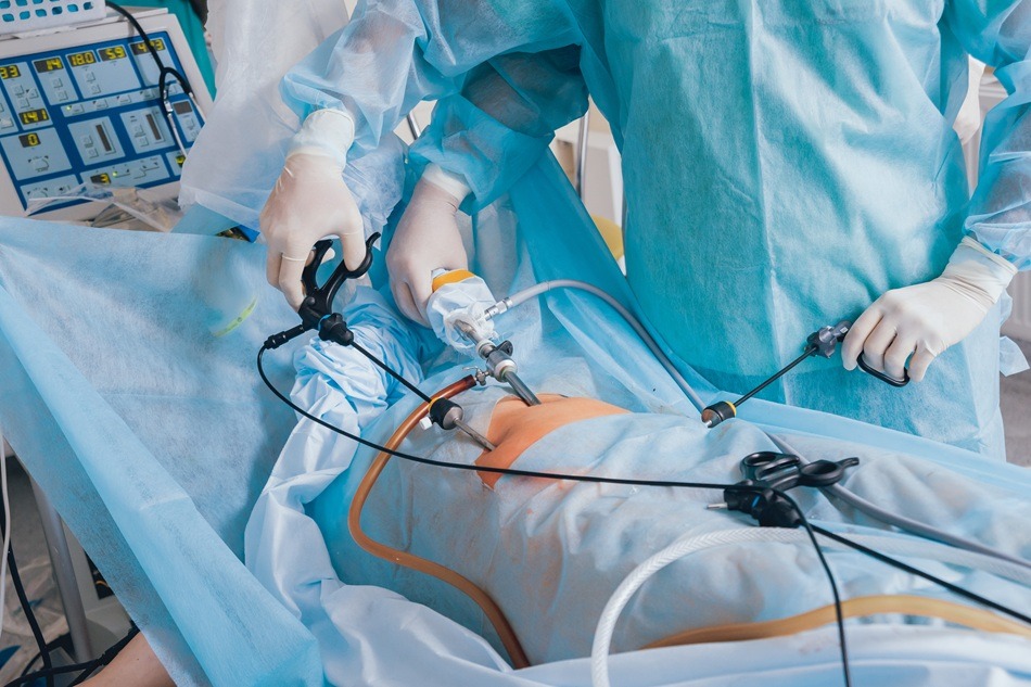 You are currently viewing TURP Surgery In Bangalore