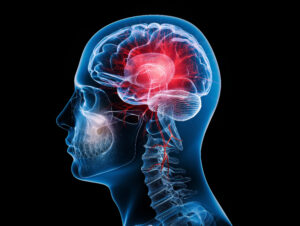 Read more about the article Early Signs of Brain Tumour You Shouldn’t Ignore